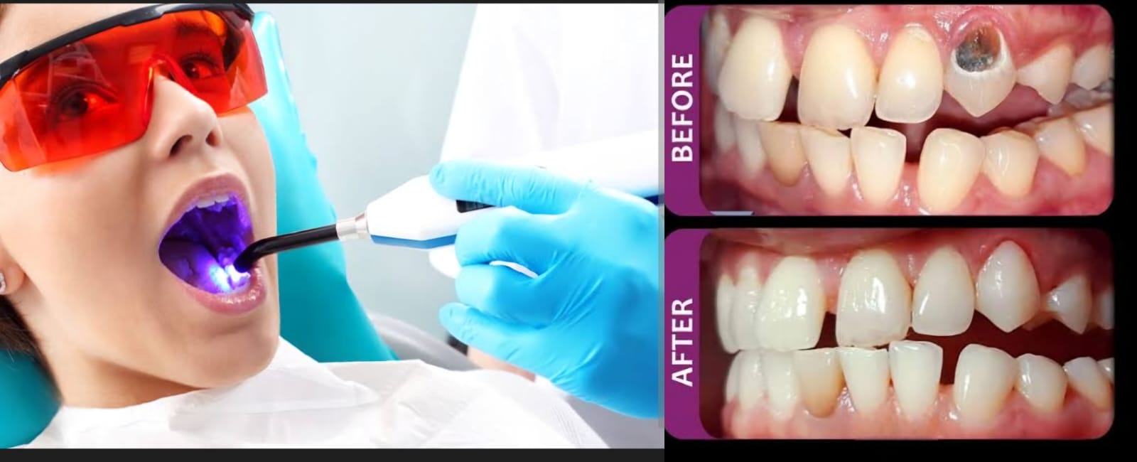 Essential dental care