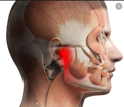 Temporomandibular Disorder (TMD)